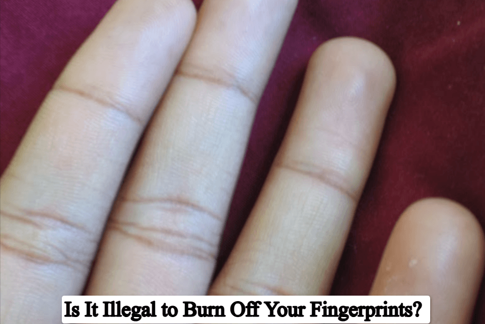 Is It Illegal to Burn Off Your Fingerprints? Complete Guide